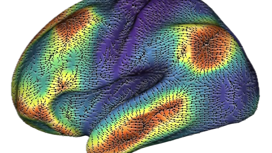 brain arrows