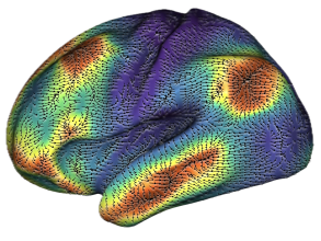 brain arrows